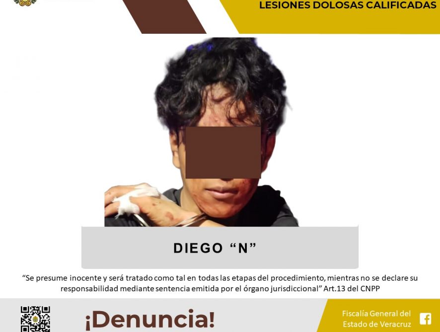 Imputado como presunto responsable de los delitos de homicidio doloso calificado y lesiones dolosas calificadas
